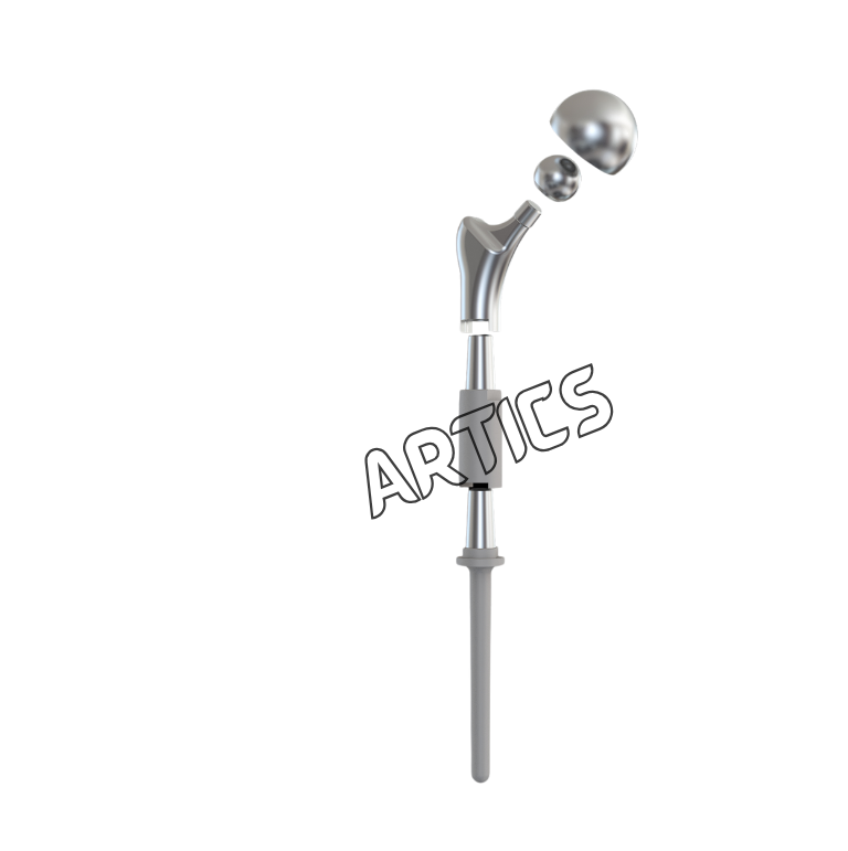 Proximal Femur Prosthesis System
